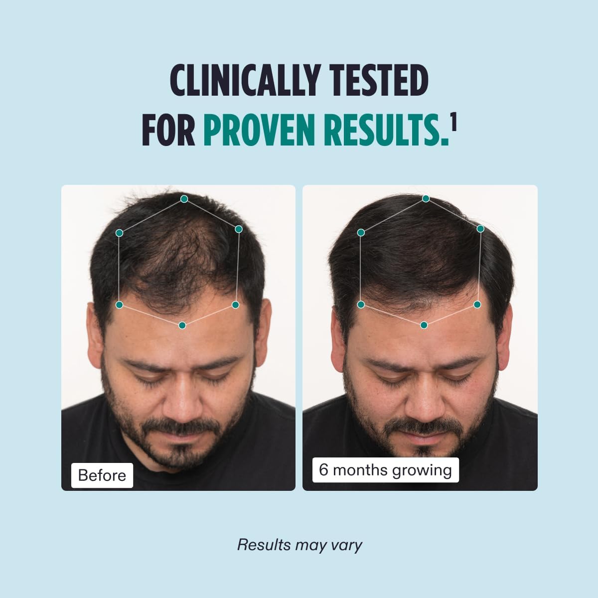 NUTRAFUL Men Hair Growth Nutraceutical Dietary Supplement-120