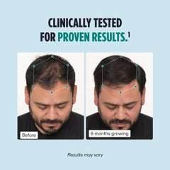 NUTRAFUL Men Hair Growth Nutraceutical Dietary Supplement-120