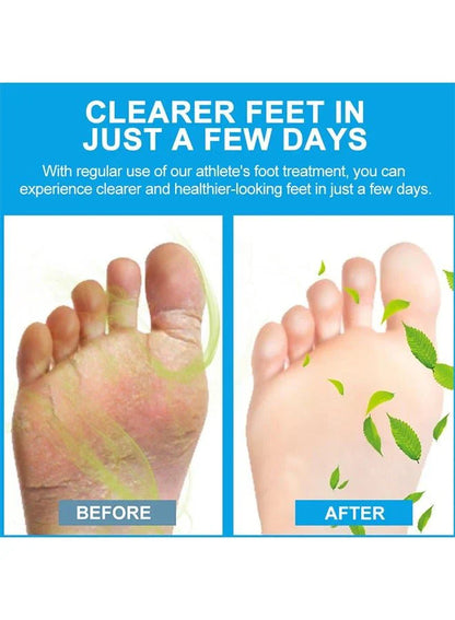 Sumifun – Foot Anti-Bacterial Cream